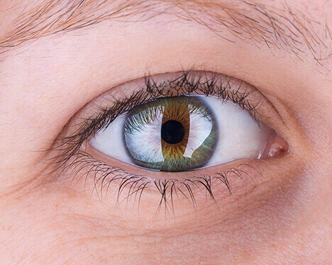 Close up of cornea